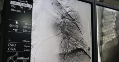 Agora realizada no HGG, angioplastia pulmonar é feita por cateterismo cardíaco, em pacientes com hipertensão pulmonar tromboembólica (Fotos: Idtech)