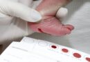 Diagnóstico precoce pelo Teste do Pezinho transforma a vida de crianças com doenças raras