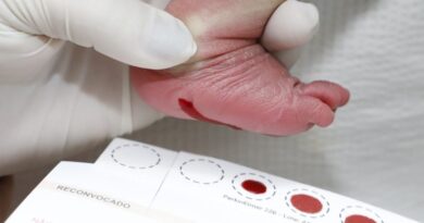 Diagnóstico precoce pelo Teste do Pezinho transforma a vida de crianças com doenças raras